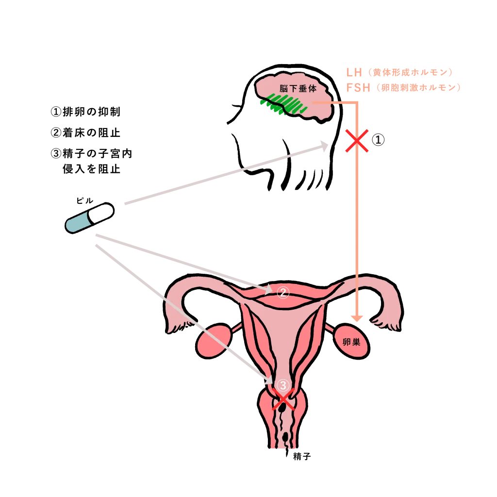 アフターピルが脳下垂体と子宮に作用し排卵抑制や着床阻止する仕組みを示す図