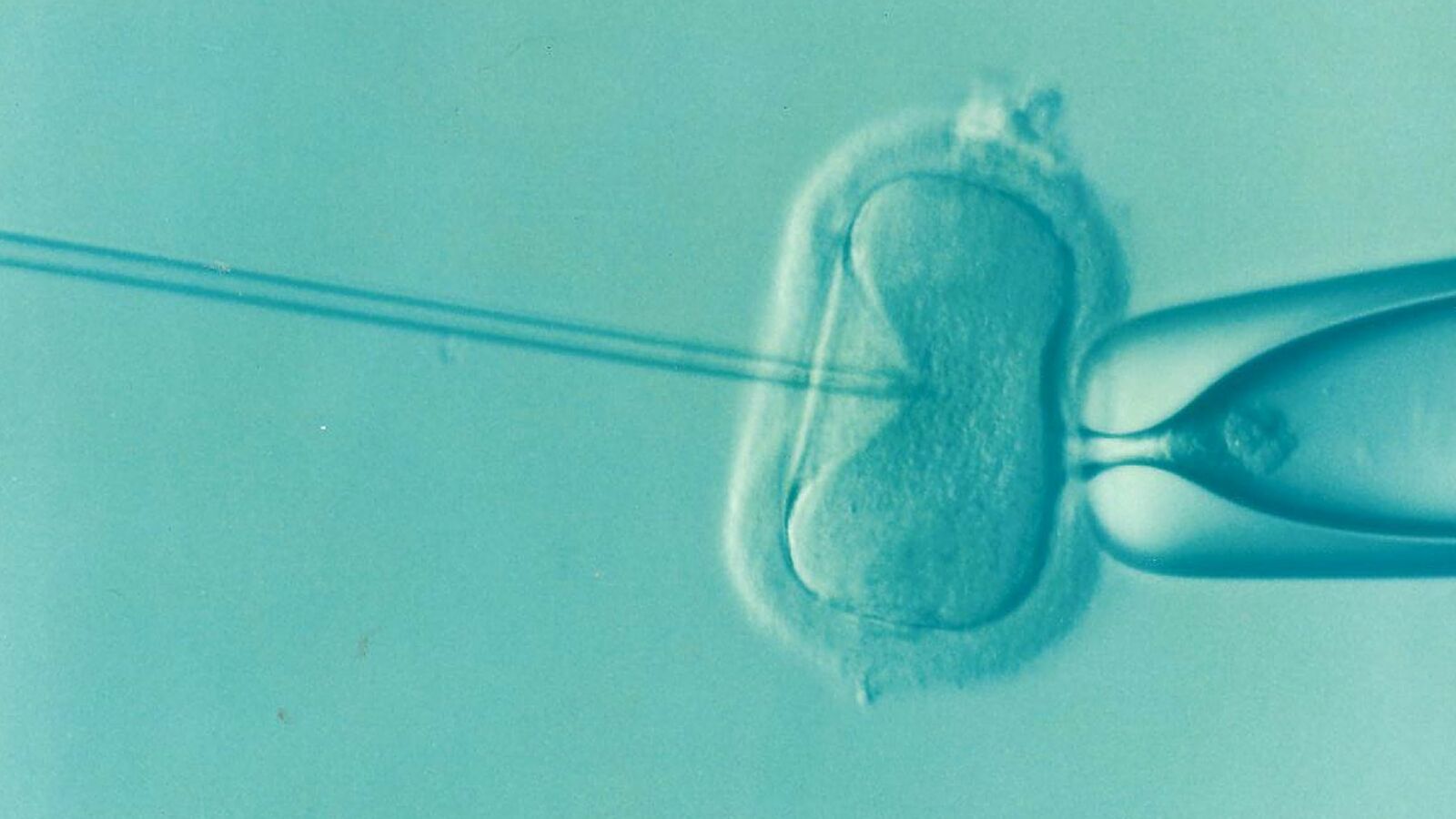 顕微授精の顕微鏡写真。左のピペットで卵子を保持し、右から細い針で精子を注入している（イメージ）