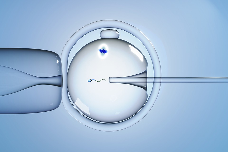 媒精／顕微授精