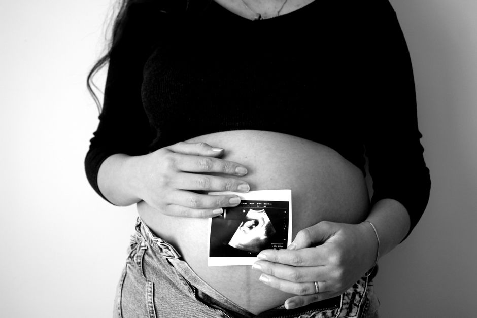 妊婦健診のイメージ